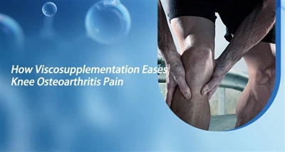کس طرح Viscosupplementation گھٹنوں کے اوسٹیو ارتھرائٹس کے درد کو کم کرتا ہے۔